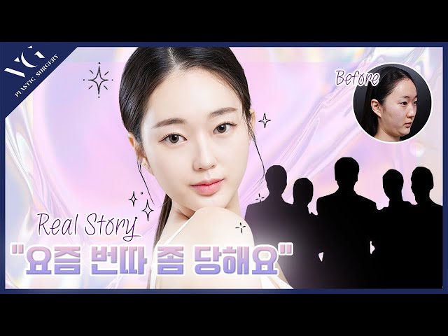 #성형브이로그 베리굿real모델이 알려주는 real후기 요새 mz한테 번따 당하는법은? 자연스럽게 예뻐진법 베리굿에서알려줄께🥰