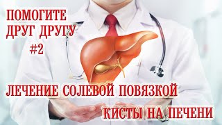 Лечение Солевой Повязкой Кисты на Печени (Помогите Друг Другу #2)