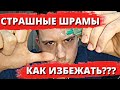 Грубые рубцы (шрамы) | Как избежать | Лечение рубцов