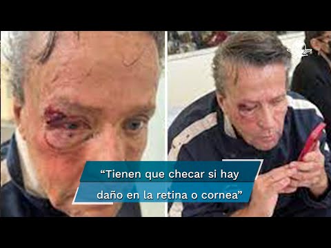 Alfredo Adame asegura que, tras golpiza, su ojo podría quedar inservible