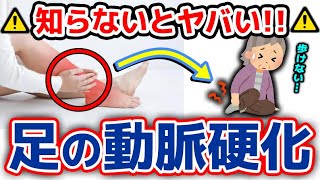 動脈硬化は足にも起きる！？症状と具体的な予防、改善方法について【下肢閉塞性動脈硬化症/原因/改善/症状】