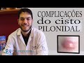 Complicações do cisto pilonidal | Dr. Marcelo Werneck