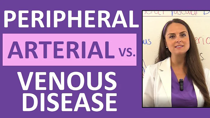 Peripheral Arterial Disease vs Peripheral Venous Disease (PAD and PVD) Nursing Symptoms