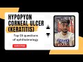 Hypopyon corneal ulcer ophthalmology| keratitis| top 15 questions of ophthalmology