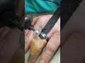 DIY Titanium Ring Removal