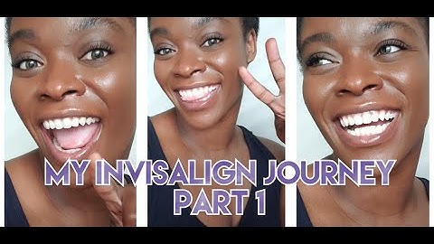Invisalign Journey - Part 1