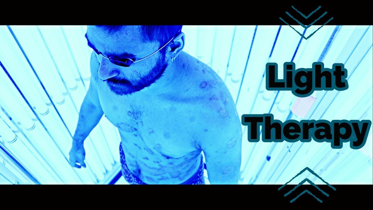 Psoriasis Treatment UVB Light Therapy Phototherapy Psoriasis Psoriasis Treatment UVB Light Therapy Phototherapy Psoriasis