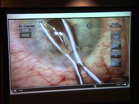 http://clinicaltrials.gov Case Presentation: Complexities Encountered in Glaucoma Patients