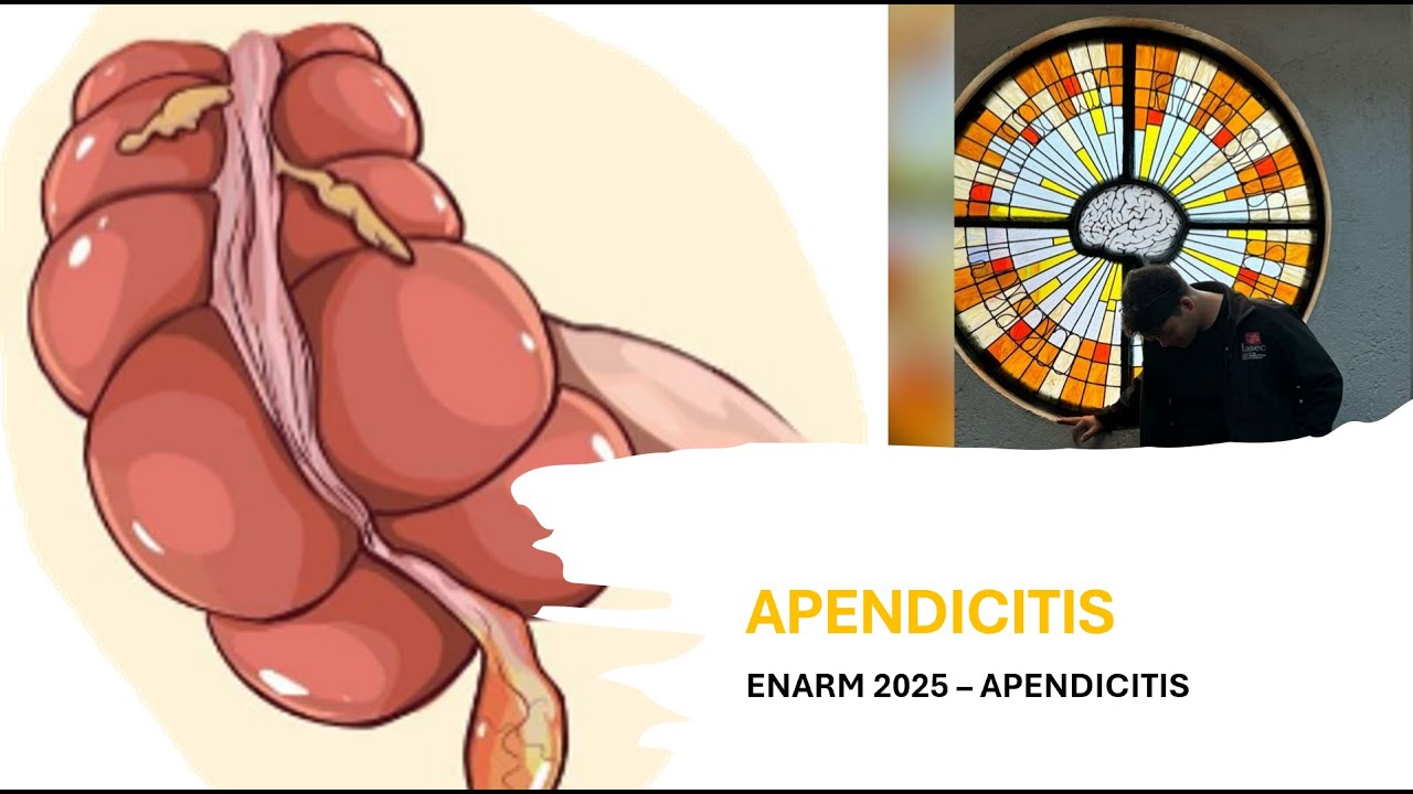 APENDICITIS // ENARM 2025 // GPC