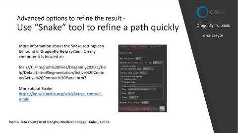 Creating a volume-of-interest using Active Contour tool
