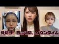 輪郭三点から半年たったってハナシ