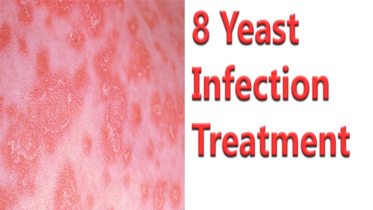 8 Remedies For Yeast Infection Treatment YouTube