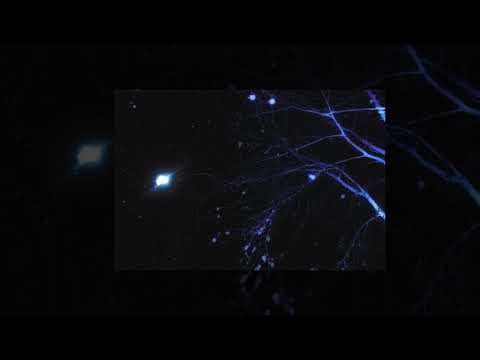 Juice Wrld x Lil Uzi Vert Type Beat - "Show Love"