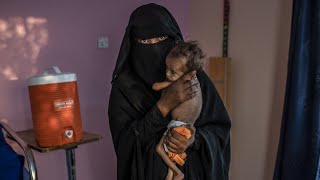 Yemen War May Have Killed 85,000 Children