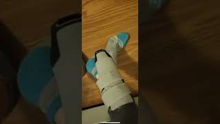 Friend mismatch socks aircast