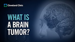 Primary Brain Tumors | What Are They and How Do They Form?