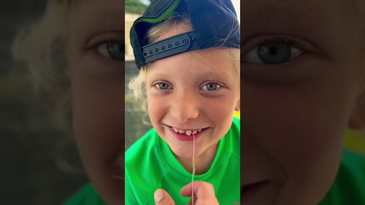 Loose Tooth VS. Stomp Rocket 