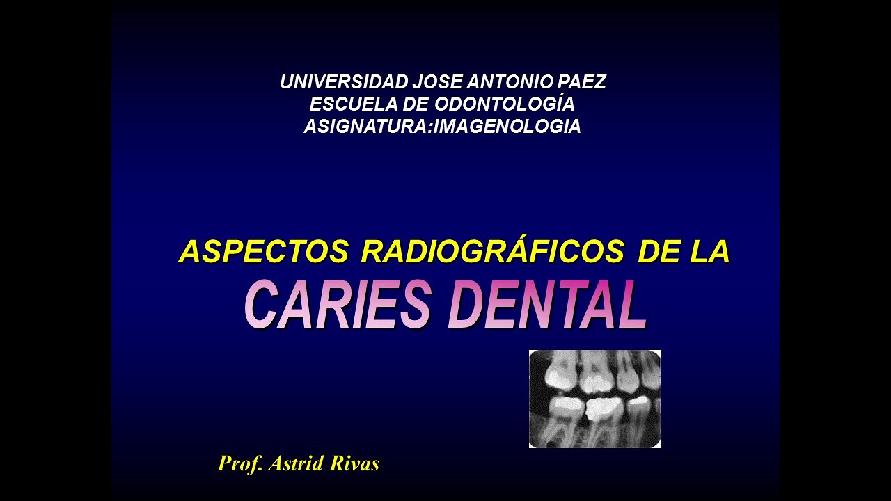 Clase de radiología de la caries dental