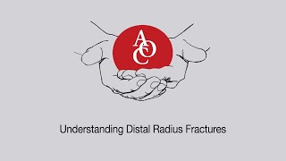 Understanding Distal Radius Fractures with Hand Surgeon, Dr. Michael Shuler