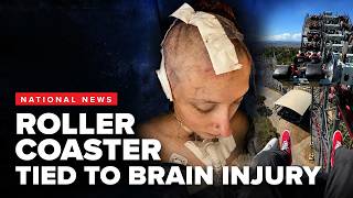 Six Flags rollercoaster linked to brain injuries