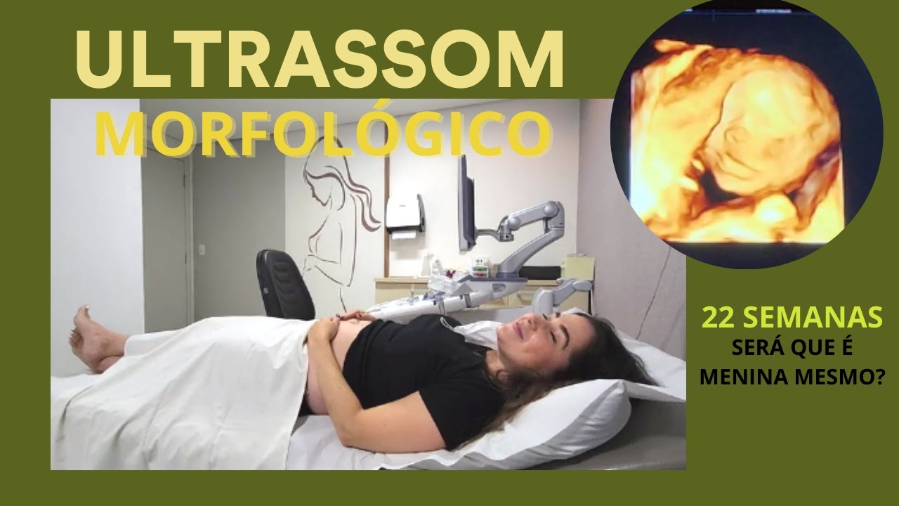 Ultrassom morfológico - Segundo trimestre l Como é feita? O que vou ver ...