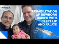 Rehabilitation of Newborn Babies with Cleft Lip and Palate