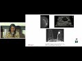 SBC Patient Summit 2026: Demystifying MDTs