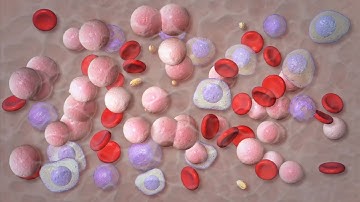 Mayo Clinic Minute - Advances in multiple myeloma treatment