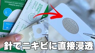 【ニキビケア】針でニキビに直接浸透❗️ニキビパッチ