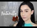 How to Cover Bruises Naturally with Makeup