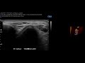 Introduction to sports ultrasound  amssm msig webinar