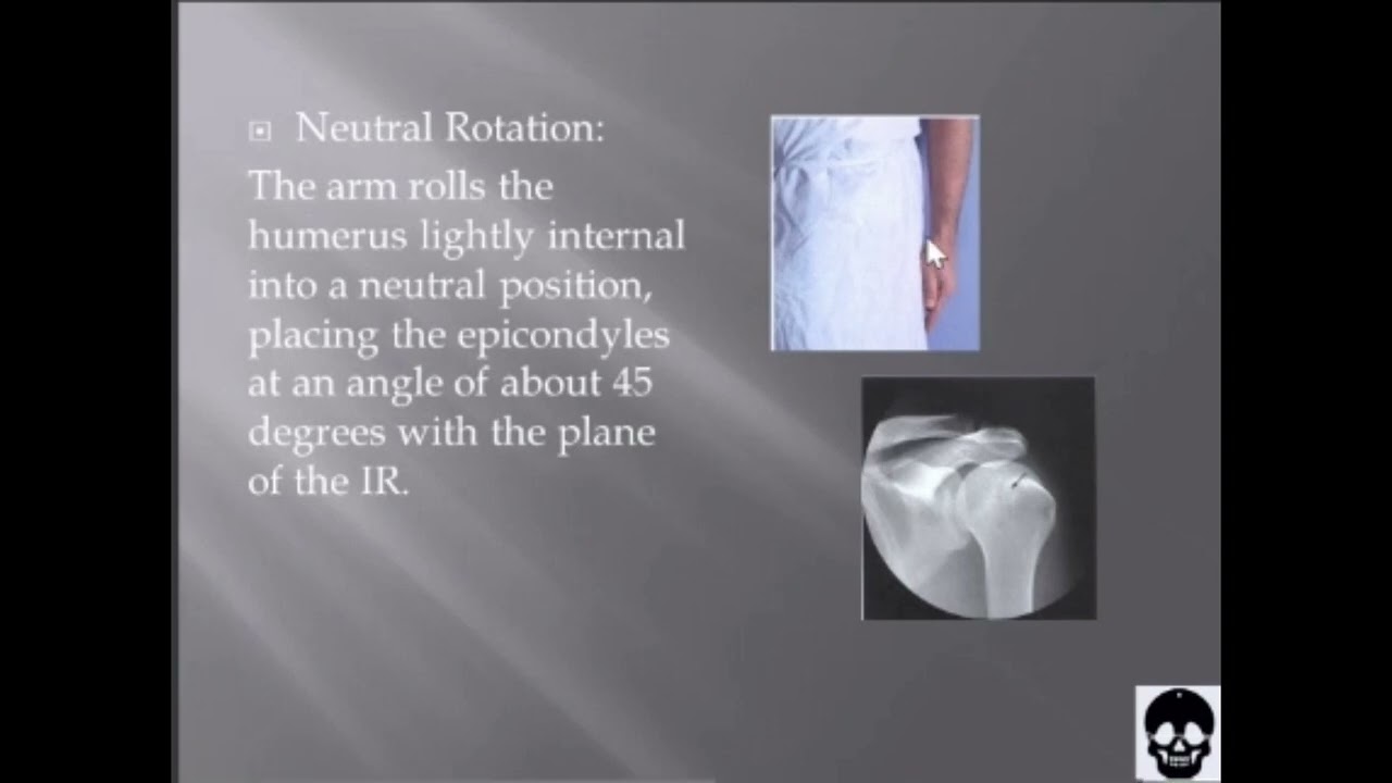 Shoulder AP Projection - External, Internal, Neutral Rotation