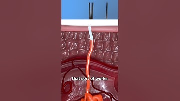 How Antiperspirants Keep You Dry 🤔