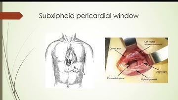 Trauma Thorax ATLS 10th