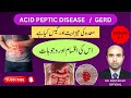 Acid reflux disease symptoms and causes gerd symptoms stomach acidity dr akhtar ali official