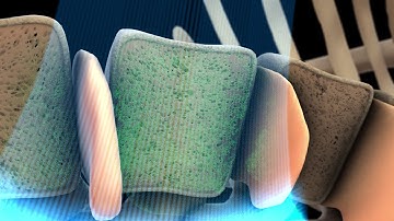 Echolight: REMS Technology Spine