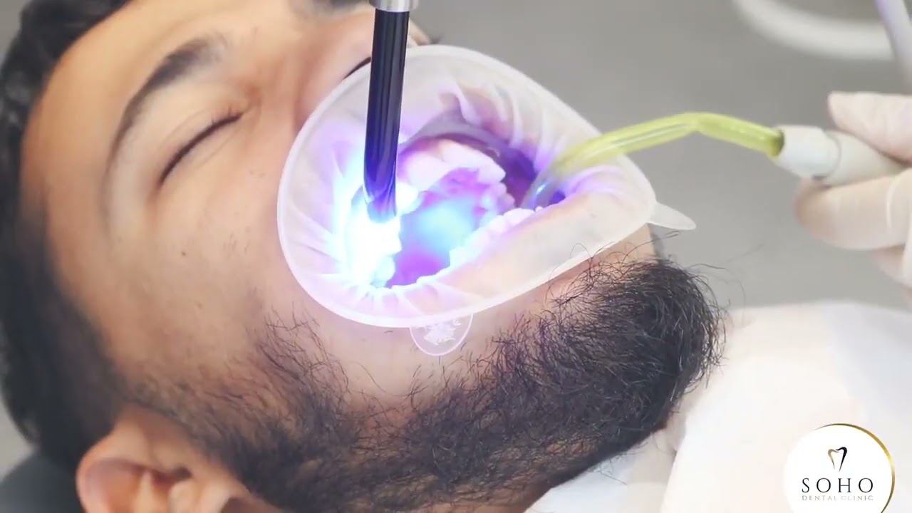 Clear Aligner Therapy: Orthodontic Treatment Without Braces