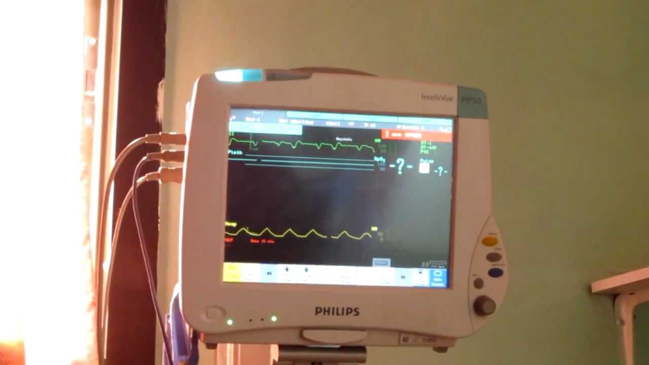 ICU Monitor for a dead person Nablus, it was sad that he didn't make it