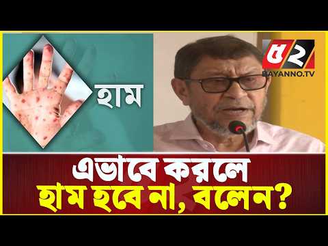 এভাবে করলে হাম হবে না, বলেন? এটাতো ছোঁয়াচে রোগ: স্বাস্থ্যমন্ত্রী | Health Minister | Hum Campaign