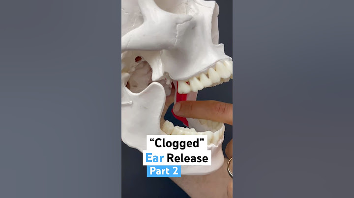 Part 2 of 2: Release your clogged ear. #earache #tmj #tmd #tinnitus