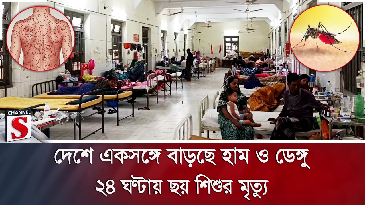 দেশে একসঙ্গে বাড়ছে হাম ও ডেঙ্গু; ২৪ ঘণ্টায় ছয় শিশুর মৃ/ত্যু | Measles | Dengue | Channel S News