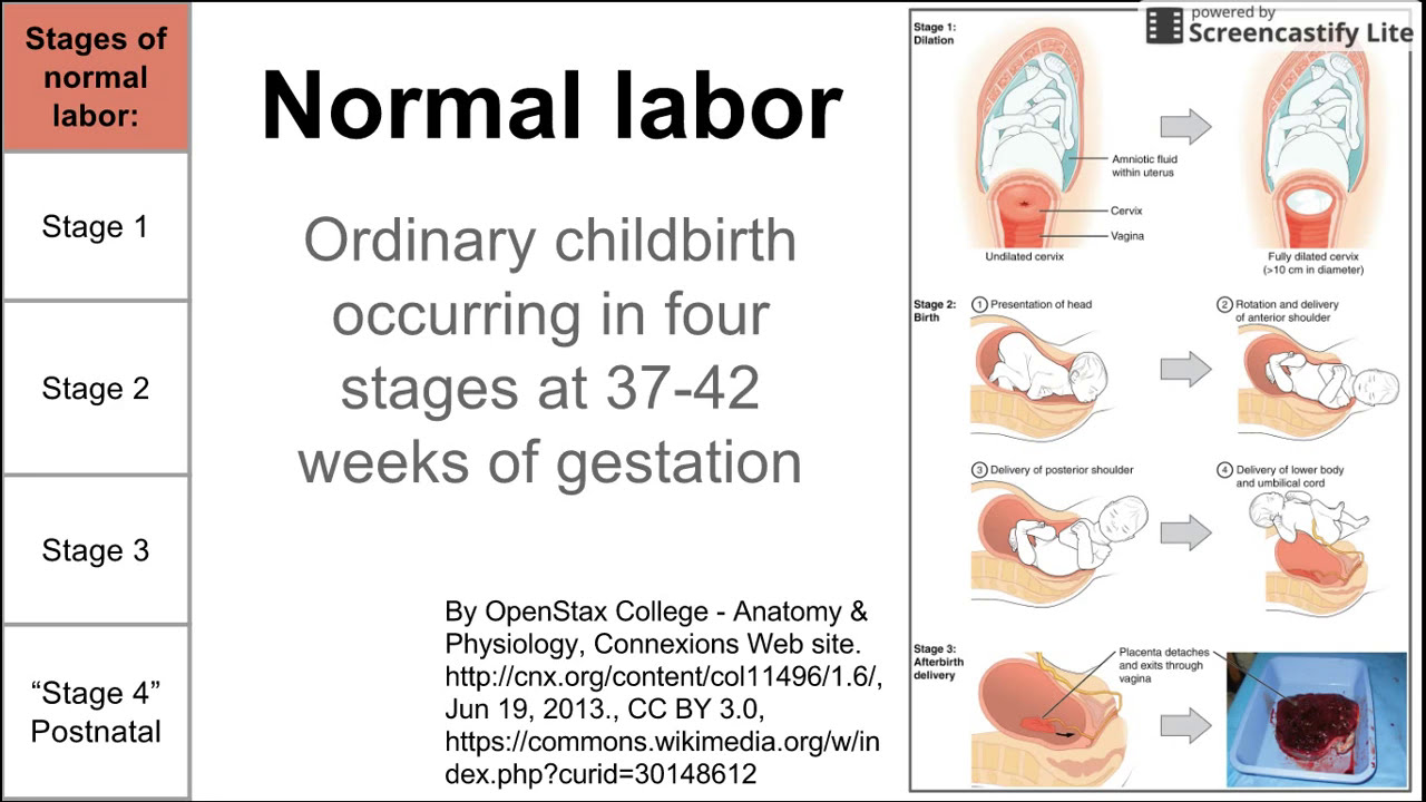 Normal Labor Ordinary Delivery Youtube