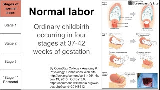 Normal labor (ordinary delivery)