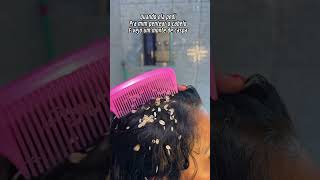Quando ela pedi pra mim pentear o cabelo e vejo um monte de caspa humor funnny c