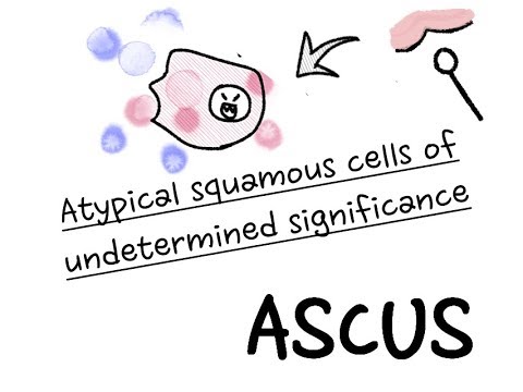 Video: Unterschied Zwischen Ascus Und Basidium