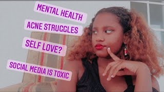 LET'S GET PERSONAL: Acne Struggles, Mental health, Self-love etc