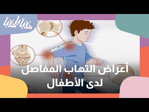 ما هي اسباب التهاب المفاصل لدى الأطفال دنيا يا دنيا صحة
