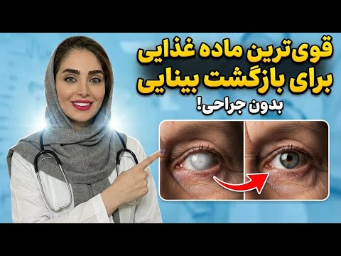 راز شوکه کننده چشم پزشک ها این غذای ارزان بینایی رو ۱۰ از ۱۰ می کنه