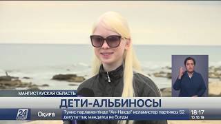 Единственная в Казахстане семья с двумя детьми-альбиносами живет в Актау