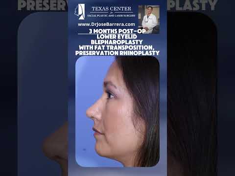 Video thumbnail: Lower Eyelid Blepharoplasty with Fat Transposition and a Preservation Rhinoplasty · Dr. Jose Barrera